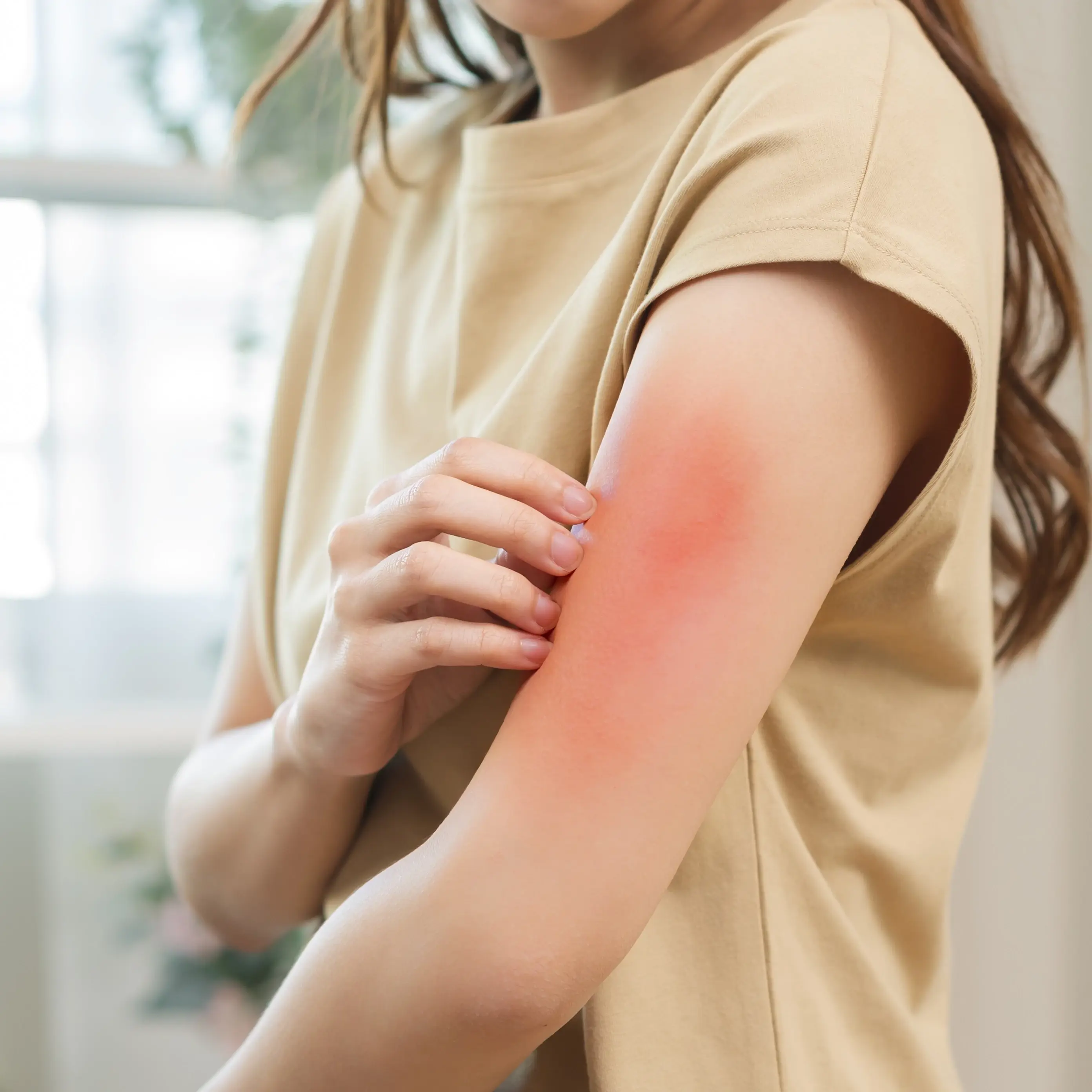 Common Household Triggers for Itchy Skin