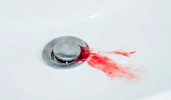 Krvácanie ďasien môže mať rôzne príčiny